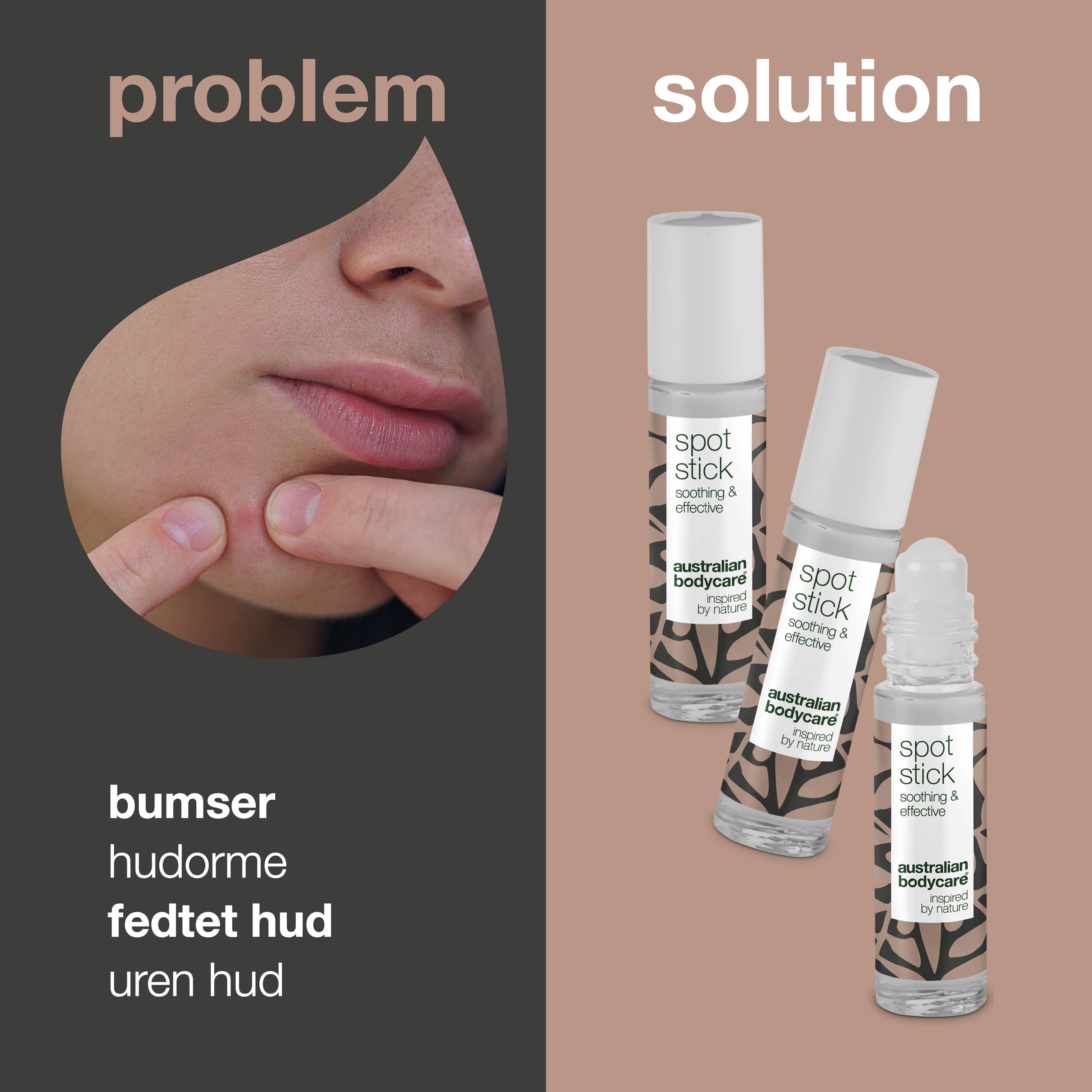 Australian Bodycare Spot Stick roll-on mod bumser, 3-pak